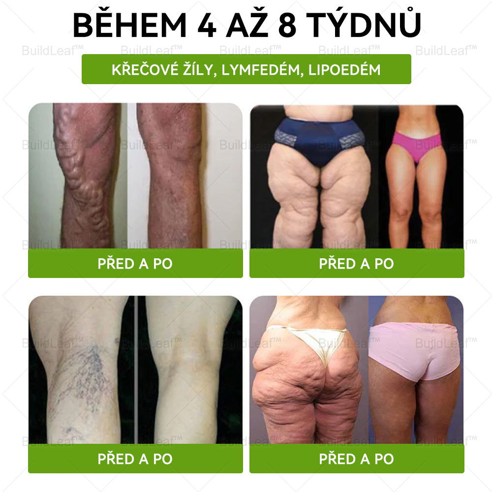 ⏰ Zbývá už jen několik kusů na skladě! Využijte speciální slevu -50%! ⏰ BuildLeaf®